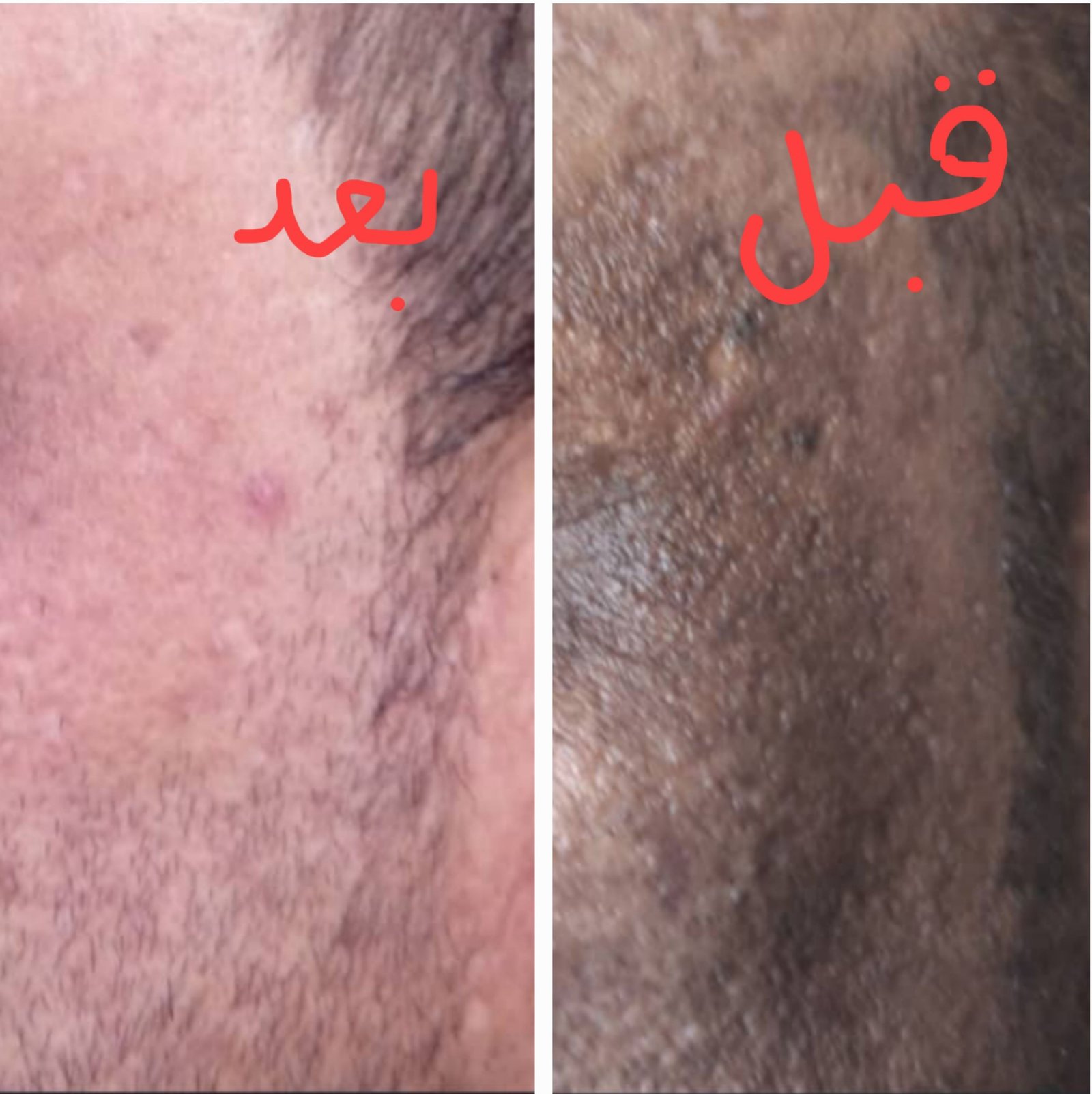 كريم تبييض الوجه أبيض